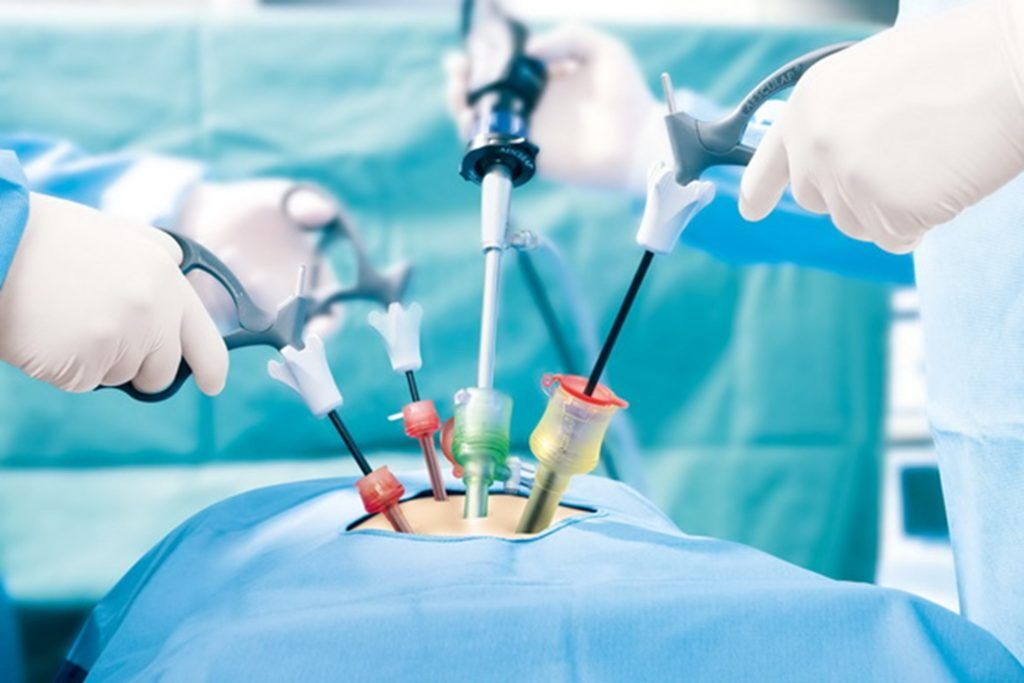 "Best Laparoscopic Surgery: The Key to Faster Recovery with Expert Dr. Kadsiddheshwar Byakodi in Hubballi, Karnataka"